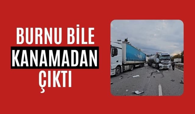 Kazadan Burnu Bile Kanamadan Çıktı
