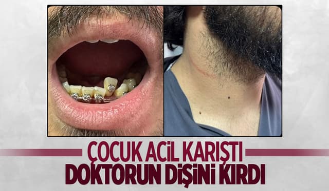 Çocuk acilde doktora saldırdı: Dişi kırıldı