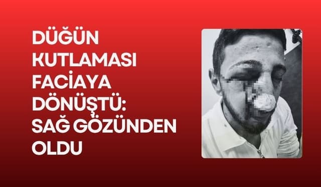 Düğün kutlaması faciaya dönüştü: Sağ gözünden oldu