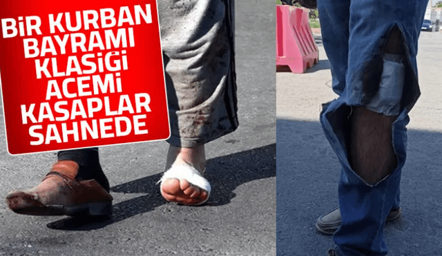 Kendilerini kesen acemi kasaplar acile koştu