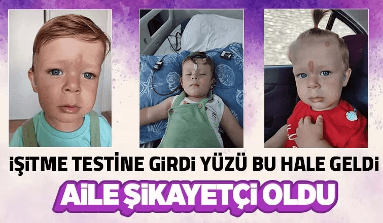İşitme Testinde İhmal İddiası  
