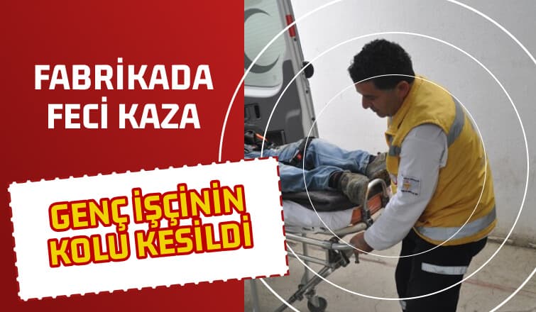 Fabrikada Feci Kaza
