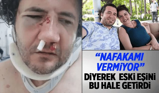 Nafaka Şiddeti, Eski Kocasını Dövdürdü  