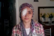 Kornea nakliyle tekrardan ışığa kavuştu