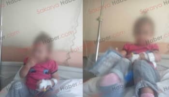 Eve giren yılan 18 aylık çocuğu ısırdı