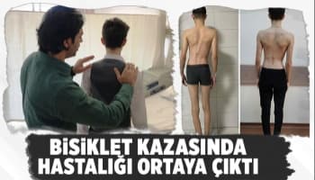 Bisiklet kazasıyla hastalığı fark edildi