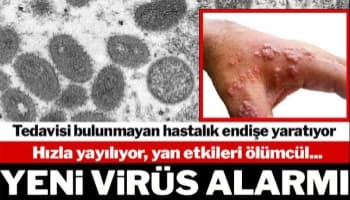 Yeni Virüs alarmı