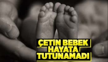 Çetin bebekten acı haber