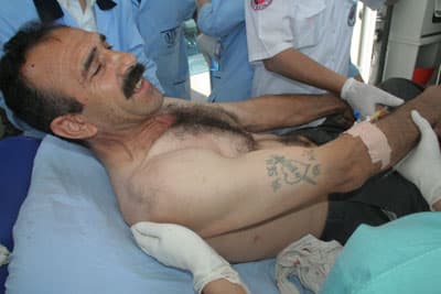 Ev Sahibi ve Kiracı Kavgası: 2 Yaralı