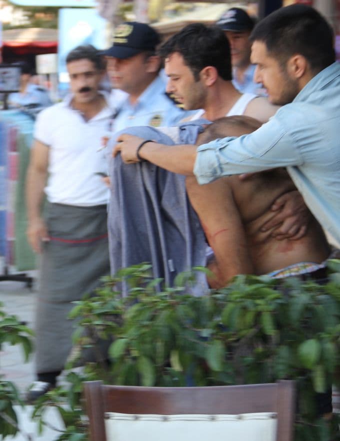 İtfaiye Caddesi'nde bir şahıs bıçakla kendini yaraladı