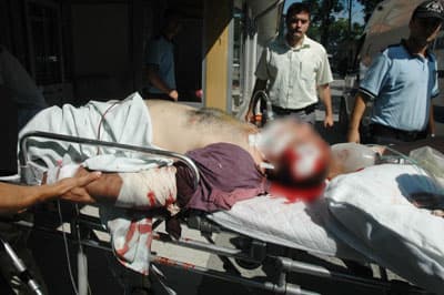 Sakarya'da Silahlı Kavga: 1 Ölü, 3 Yaralı