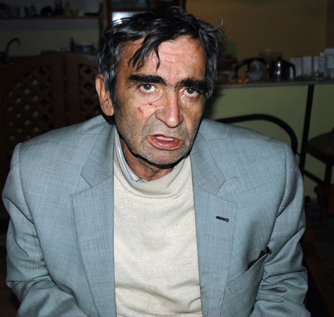 Isınmak için sobaya sarılarak kendini yaktı