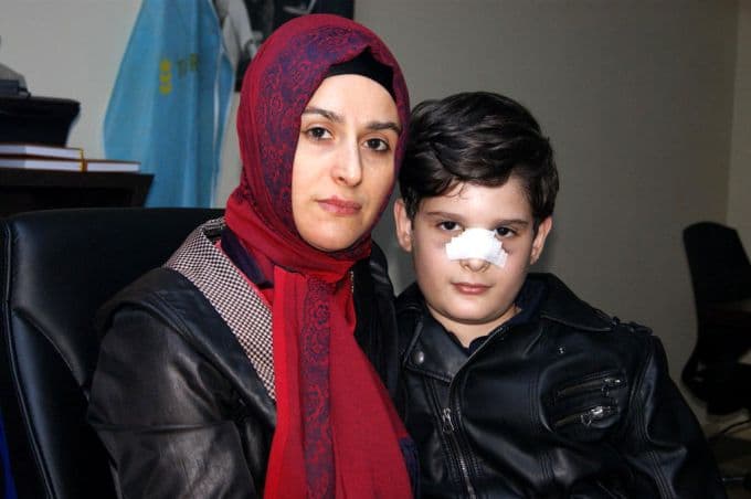 Okulda burnu kırılan çocuğun annesinden şok iddia