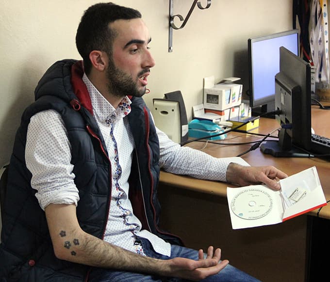 MR çekilecek gence 'dövme' engeli