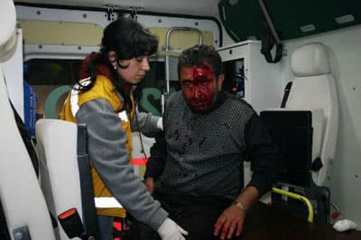TEM'de Kaza: 2 Yaralı