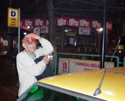 Trafik Kazası: 1 Yaralı