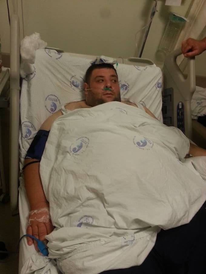 Sapancalı Ersin, zayıflamak isterken hayatından oldu