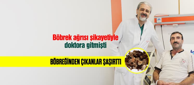 Böbreğinden çıkanlar şaşırttı