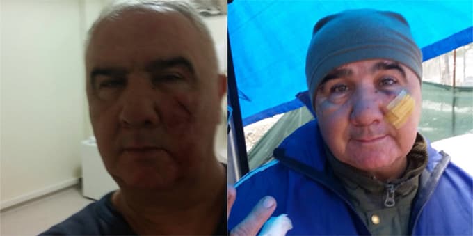 Turgay Özbalkan'a çirkin saldırı