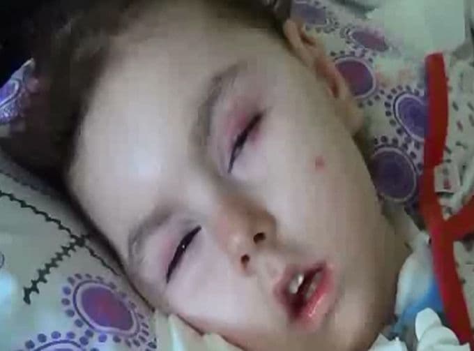 Yardım edilmezse minik Ecrin hayatını kaybedecek