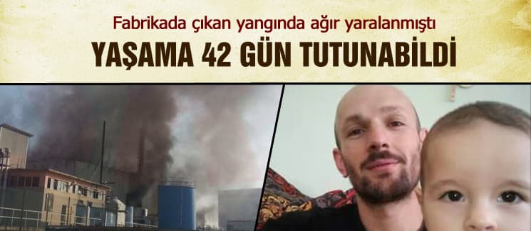 Fabrika yangınında yaralanmıştı, hayatını kaybetti