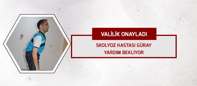 Skolyoz hastası Güray, operasyon geçirecek
