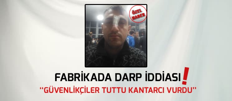 "Güvenlikçiler tuttu kantarcı vurdu!"