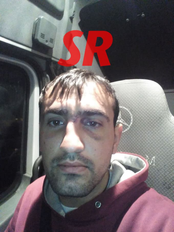 "Güvenlikçiler tuttu kantarcı vurdu!"