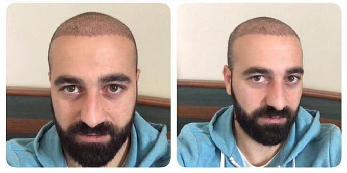 Fahri Tatan, saç ektirdiği için takımdan kovuldu