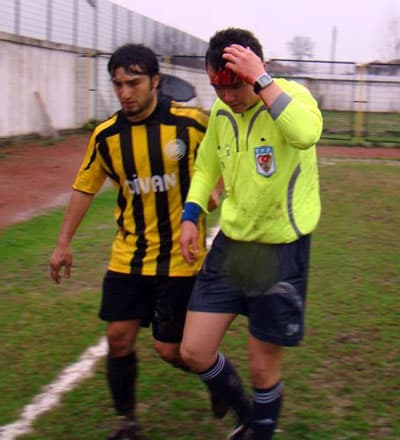 Başına Taş İsabet Eden Hakem Yere Yığıldı 