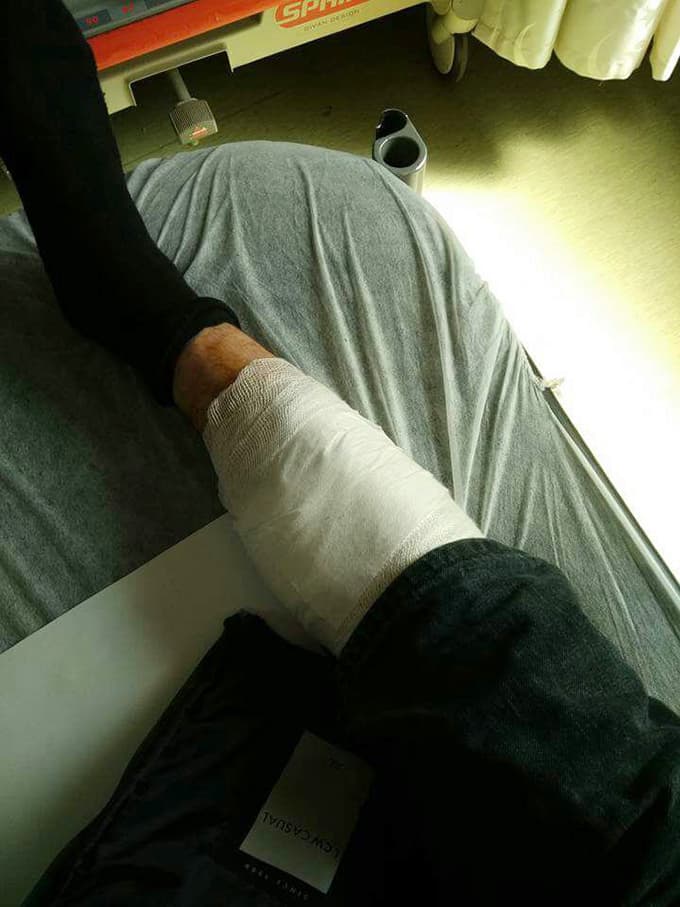 Tırpan motorunun fırlattığı tel, bacağına saplandı