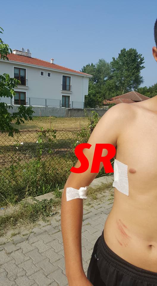 Sakaryalı milli sporcu köpeklerin saldırısına uğradı