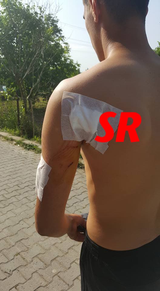 Sakaryalı milli sporcu köpeklerin saldırısına uğradı