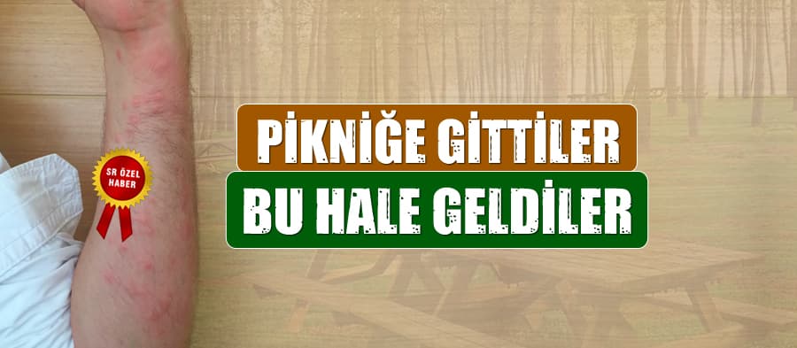 Pikniğe gittiler, bu hale geldiler
