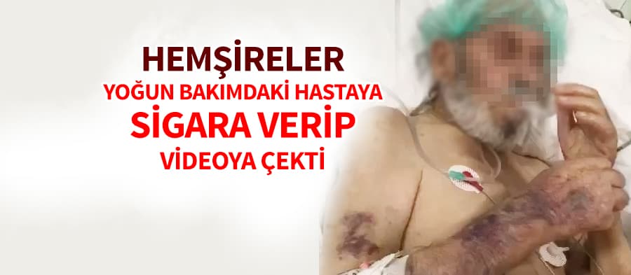 Hemşireler yoğun bakımdaki hastaya sigara verdi