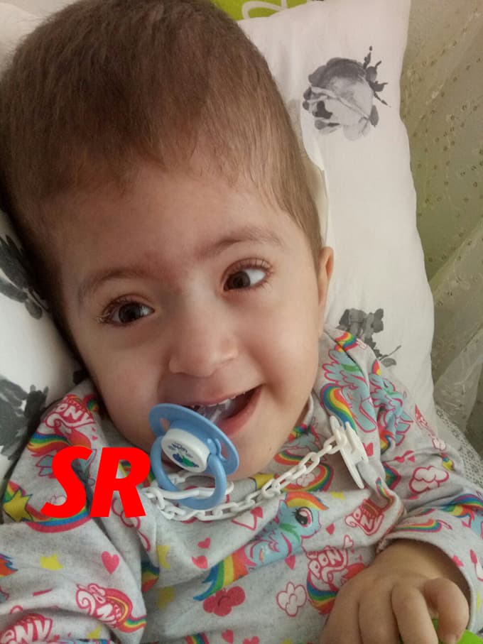 3 yaşındaki Ümmü Gülsüm bebek yardım bekliyor