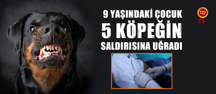 9 yaşındaki çocuk 5 köpeğin saldırısına uğradı