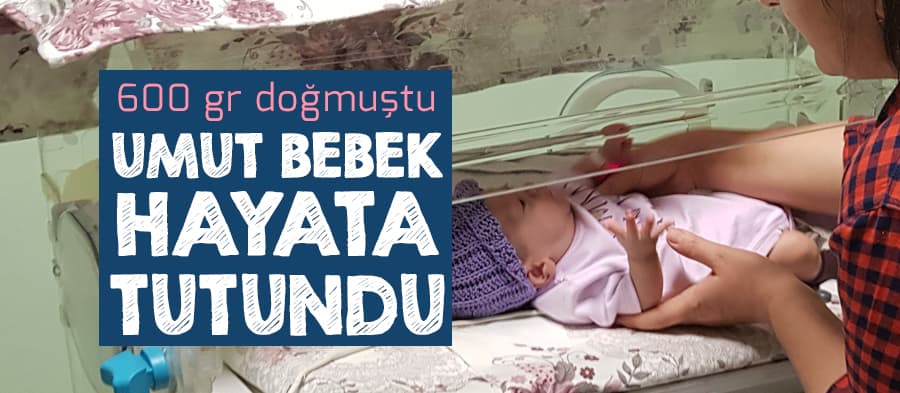 Umut bebek hayata tutundu