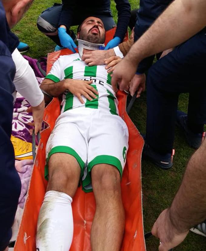 Sapancaspor oyuncusu Bursa deplasmanında yaralandı