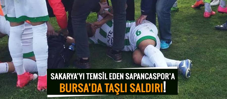 Sapancaspor oyuncusu Bursa deplasmanında yaralandı