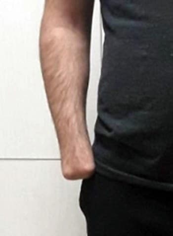 Hırsızlık suçundan eli kesilen şahıs Sakarya'da yakalandı