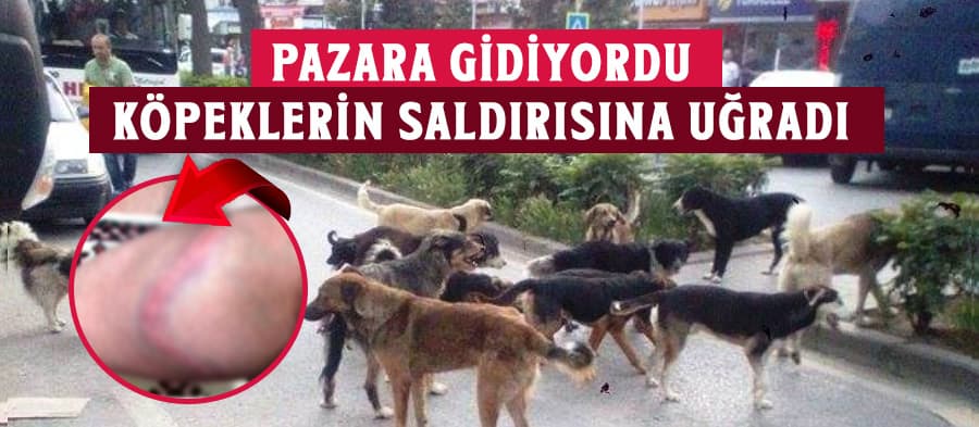Köpeğin Saldırısına Uğrayan Kadın Hastanelik Oldu