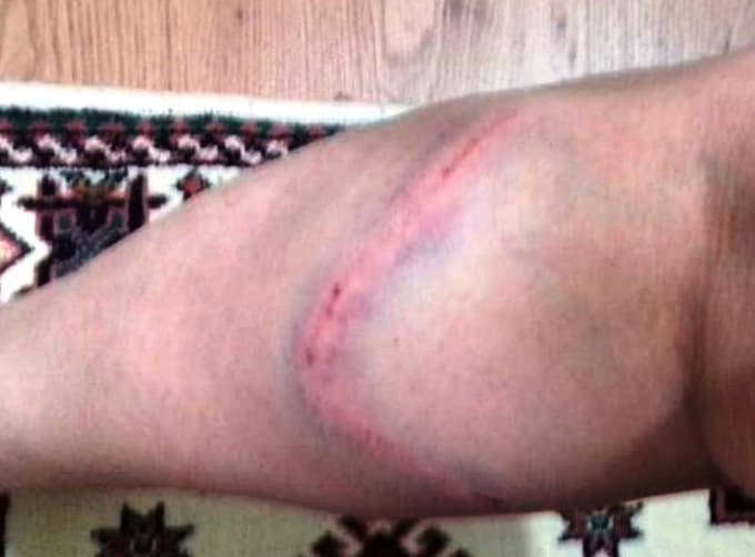 Köpeğin Saldırısına Uğrayan Kadın Hastanelik Oldu