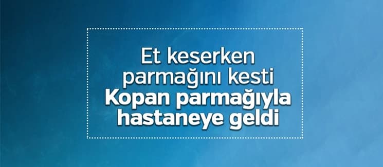 Kurban keserken parmağını kopardı