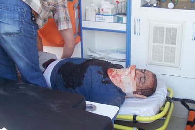 Tem Otoyolu'nda Kaza: 1 Ölü, 2 Yaralı