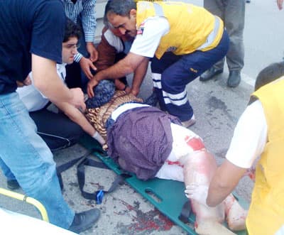 Sapanca'da Trafik Kazası: 1 Yaralı
