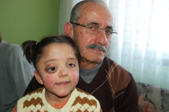 Küçük kız ameliyat olmazsa gözü patlayacak