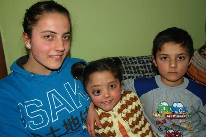 Küçük kız ameliyat olmazsa gözü patlayacak