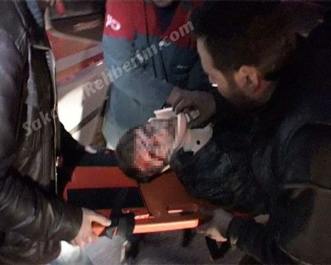 Kepçe Otomobili Jilet Gibi Kesti