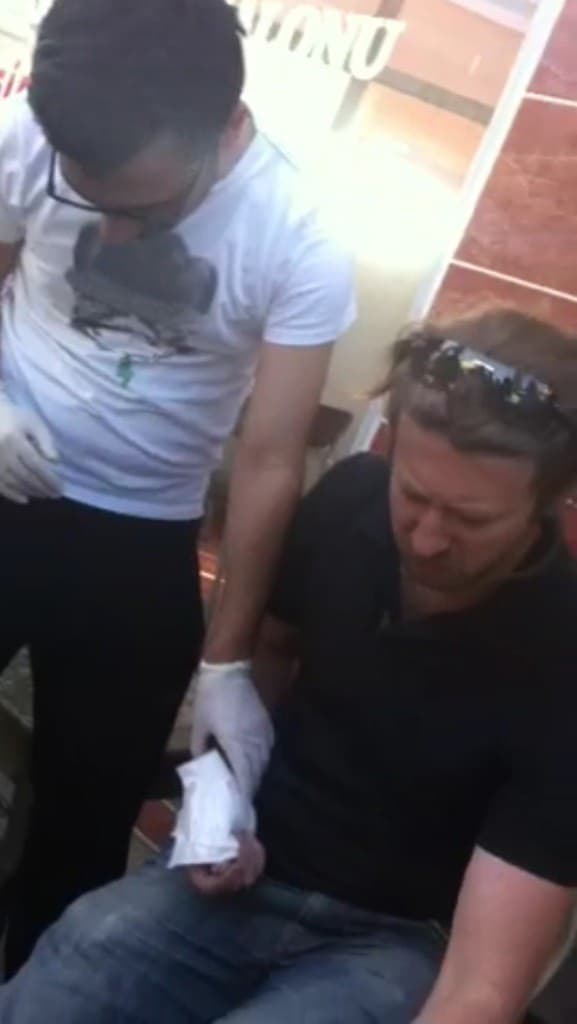 Trafik kazasında 1 kişi yaralandı